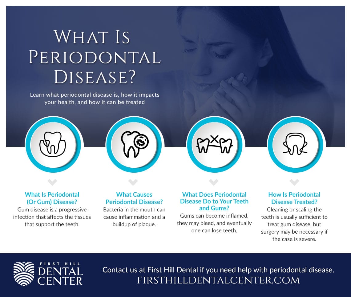 What Is Periodontal Disease?